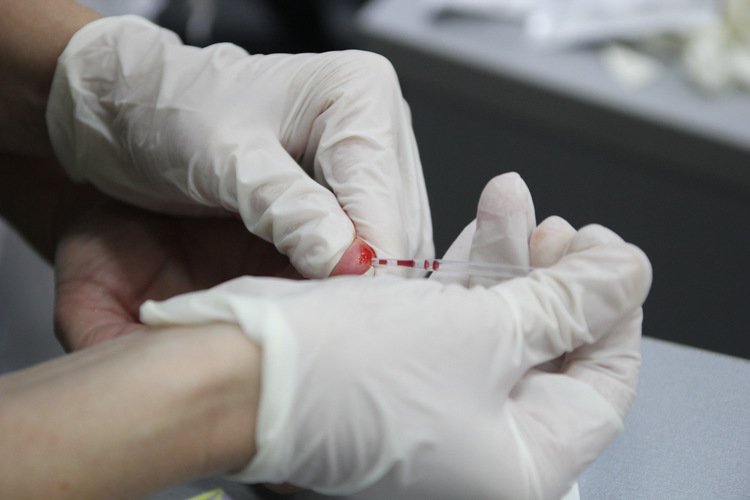 До Всесвітнього дня боротьби з гепатитом у Василькові проведуть інформаційно-профілактичну акцію