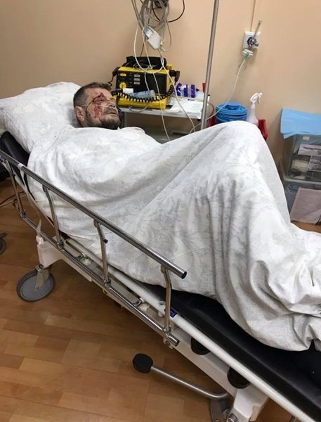 Замах на Мосійчука: чотири людини постраждали і одна померла