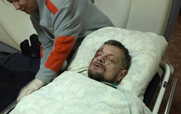 Замах на Мосійчука: чотири людини постраждали і одна померла