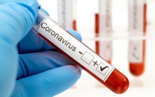 У Київській області за час епідемії померло 59 хворих на COVID-19