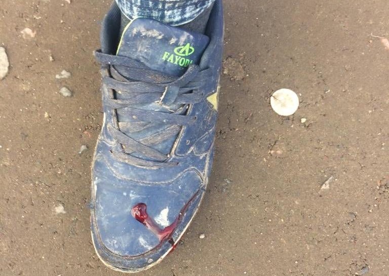 На Васильківщині поліцейські затримали озброєного хулігана